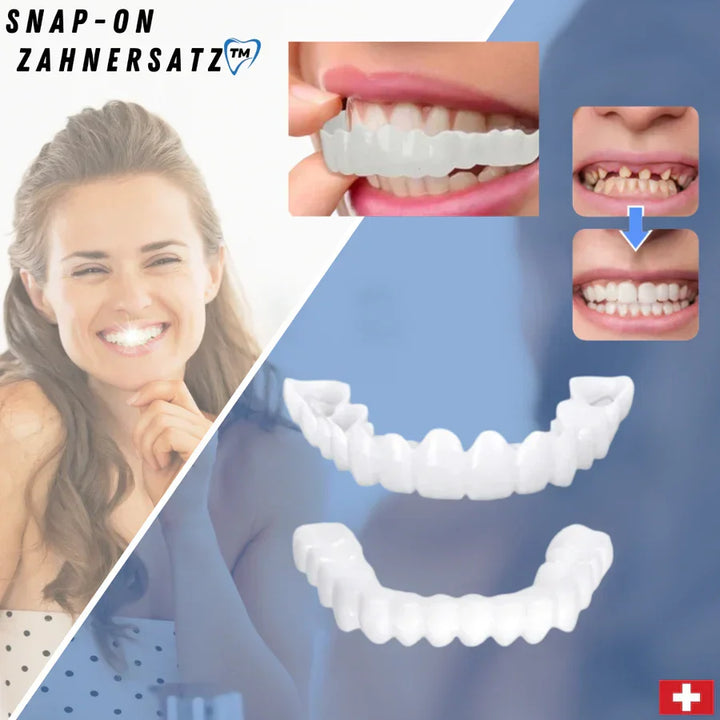 Women's SnapFit dental restoration for an instant perfect, bright white smile, enhancing confidence.