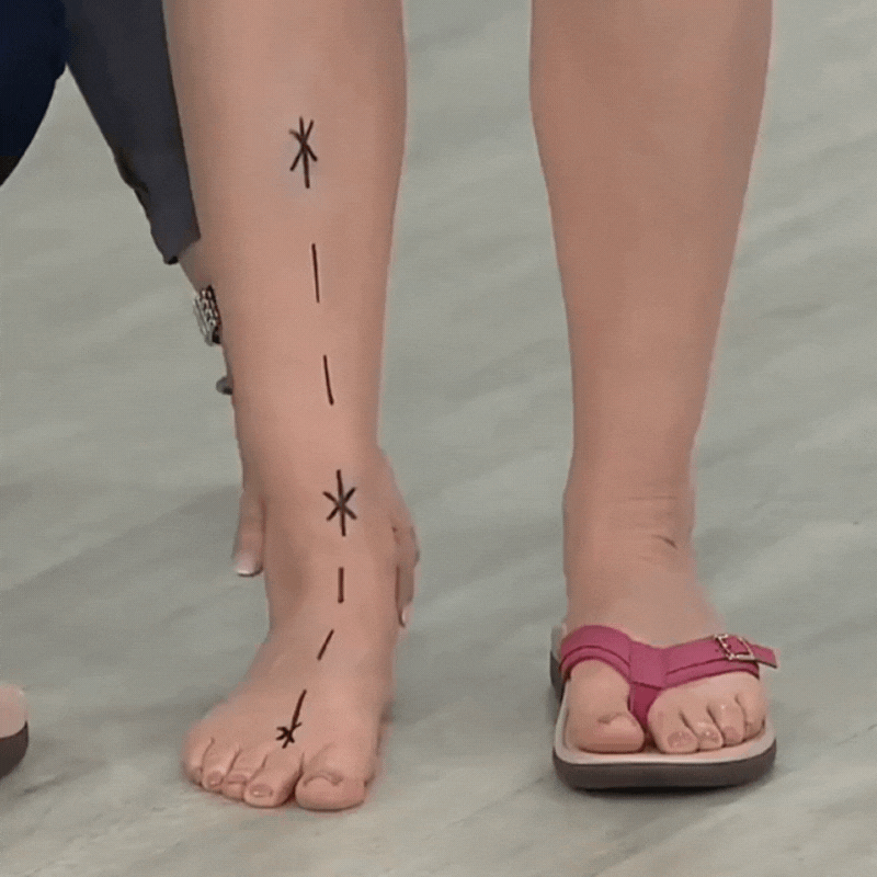 Soft & supportive open-toe orthopedic sandals for women, ideal for all-day summer comfort.