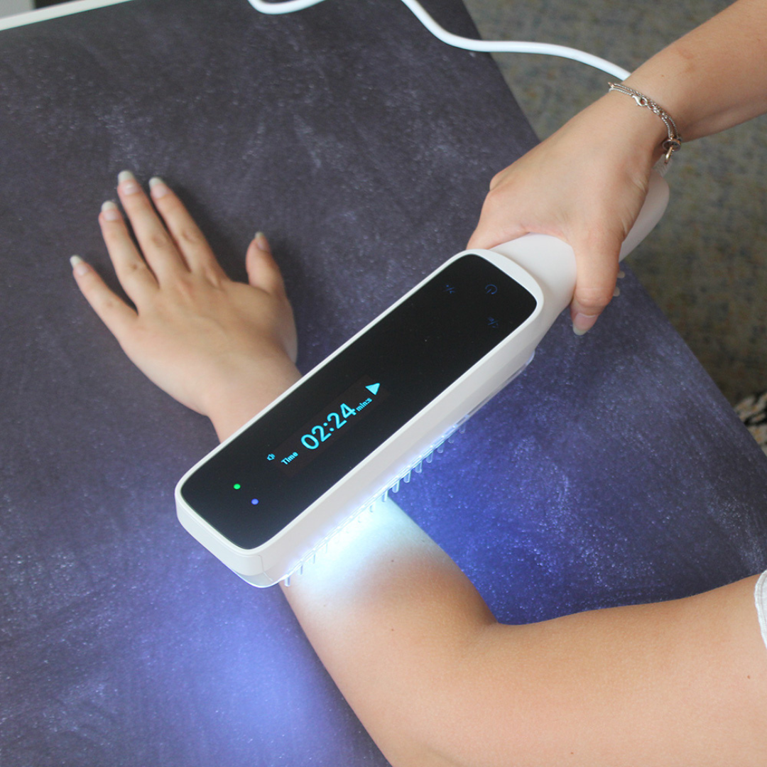 "Compact handheld UVB phototherapy lamp for psoriasis, vitiligo treatment; ideal for scalp, hands, joints; travel-friendly."