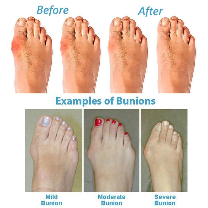 Comfortable women's orthopaedic sandals with ergonomic design and supportive arch for foot health.