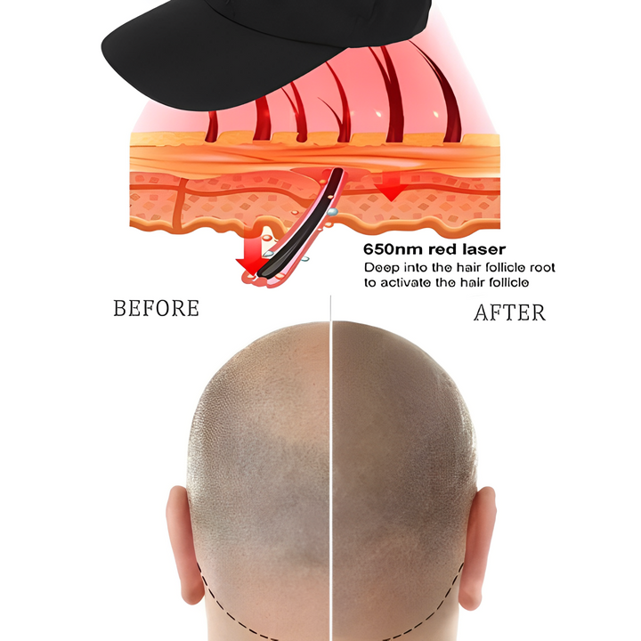 "Unisex red light infrared laser cap for hair growth, featuring advanced LED and laser technology for dense, healthy hair."